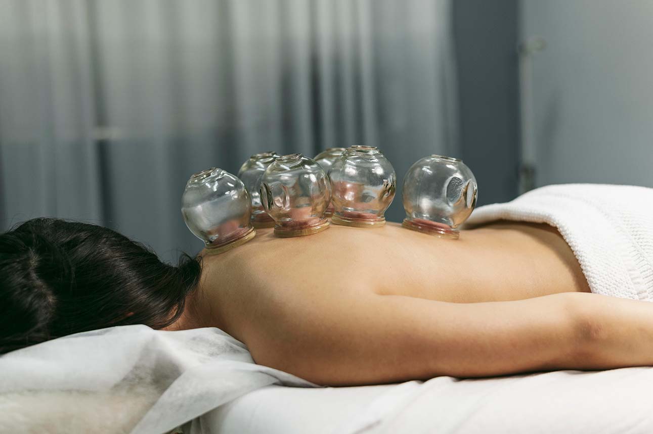 Cupping